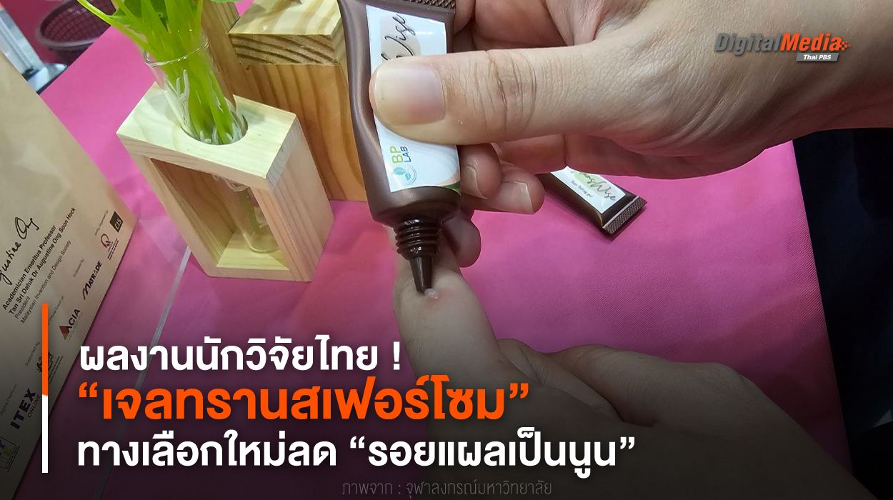 “เจลทรานสเฟอร์โซม” ทางเลือกใหม่ลด “รอยแผลเป็นนูน”