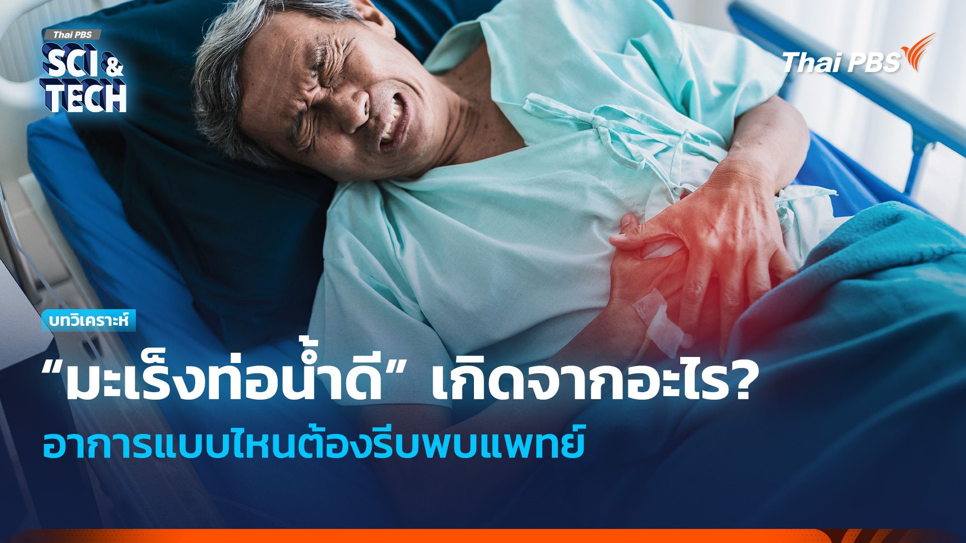 “มะเร็งท่อน้ำดี” เกิดจากอะไร? อาการแบบไหนต้องรีบพบแพทย์