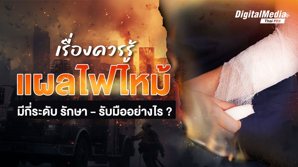 เรื่องควรรู้ “แผลไฟไหม้” มีกี่ระดับ รักษา - รับมืออย่างไร ?