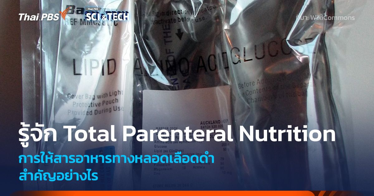 รู้จัก Total Parenteral Nutrition หรือการให้สารอาหารทางเส้นเลือด
