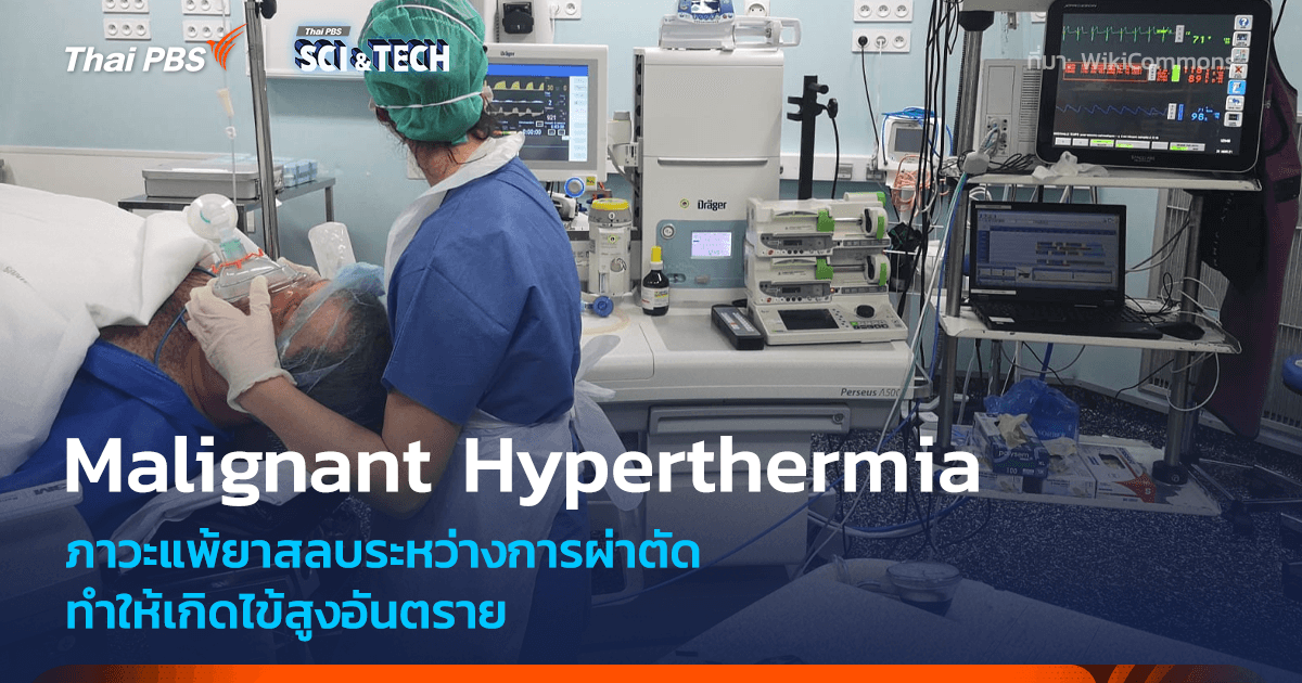 Malignant Hyperthermia ภาวะแพ้ยาสลบที่ทำให้เกิดไข้สูงอันตรายระหว่างการผ่าตัด