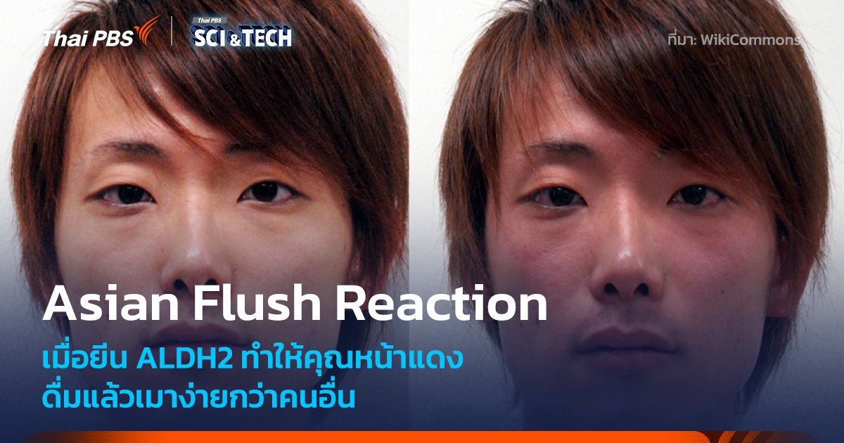 รู้จัก Asian Flush Syndrome เมื่อยีน ALDH2 ทำให้ “หน้าแดง” ดื่มแล้วเมาง่ายกว่าคนอื่น
