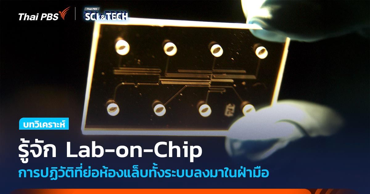รู้จัก Lab-on-Chip การปฏิวัติที่ย่อห้องแล็บทั้งระบบลงมาในฝ่ามือ