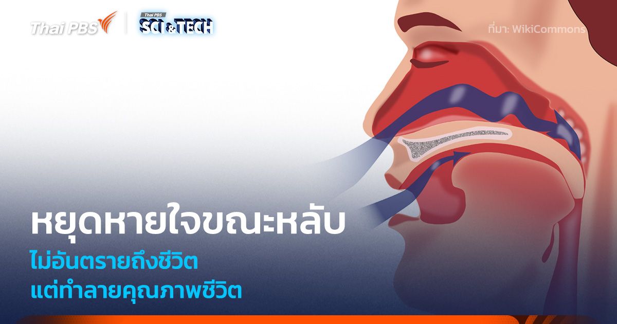 รู้จัก “ภาวะหยุดหายใจขณะหลับ” ไม่ถึงตายแต่ทำลายคุณภาพชีวิต