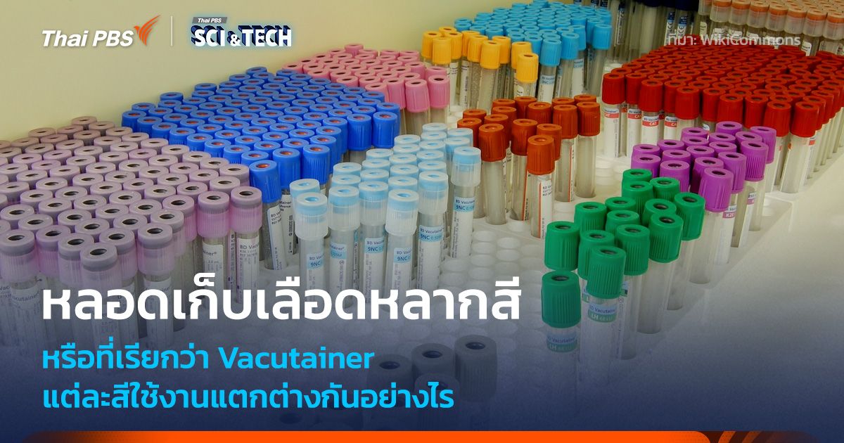Vacutainer หรือหลอดเก็บเลือดหลากสี ต่างกันอย่างไร?