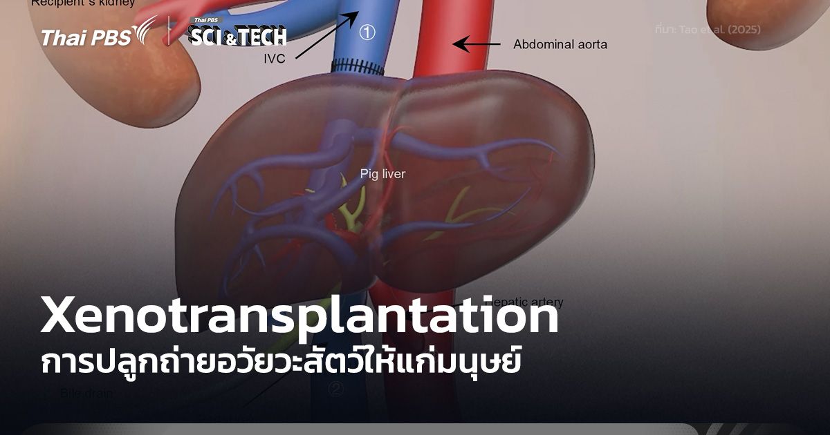 Xenotransplantation การปลูกถ่ายอวัยวะหรือเซลล์จากสัตว์อื่น ๆ