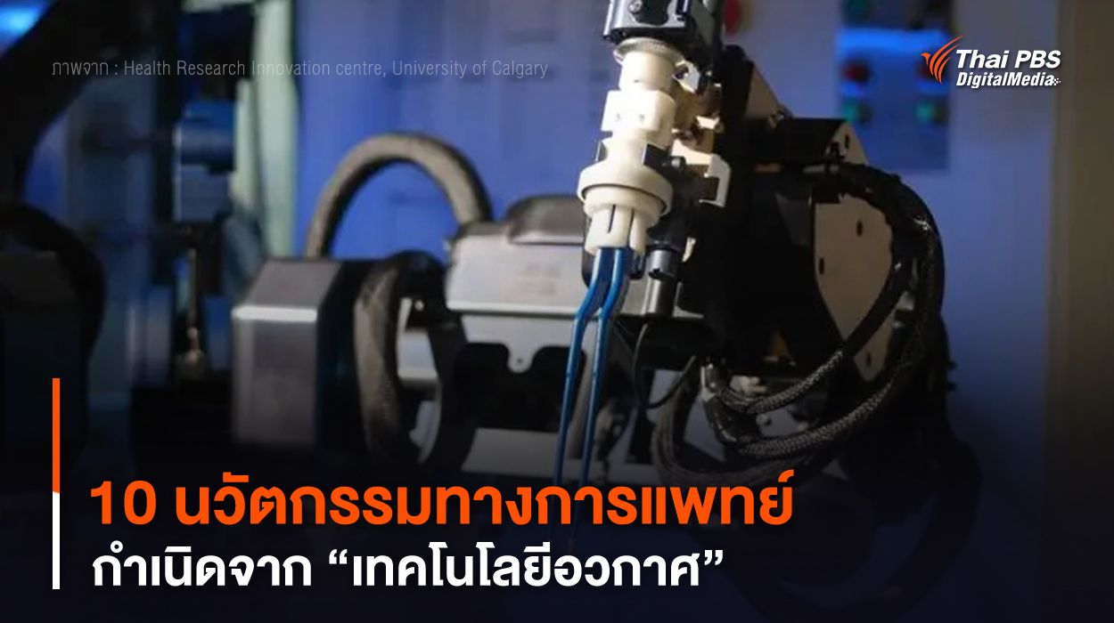 10 นวัตกรรมทางการแพทย์ กำเนิดจาก “เทคโนโลยีอวกาศ”
