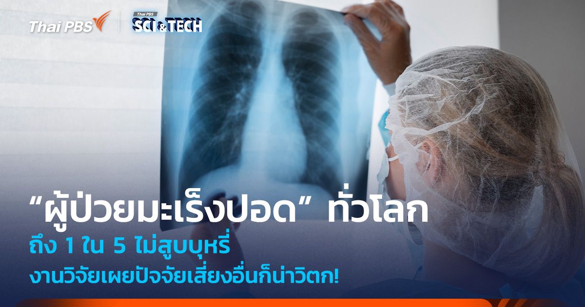 ปัจจัยเสี่ยงอื่นก็น่าวิตก! งานวิจัยเผย “ผู้ป่วยมะเร็งปอด” ทั่วโลก 1 ใน 5 ไม่สูบบุหรี่ 