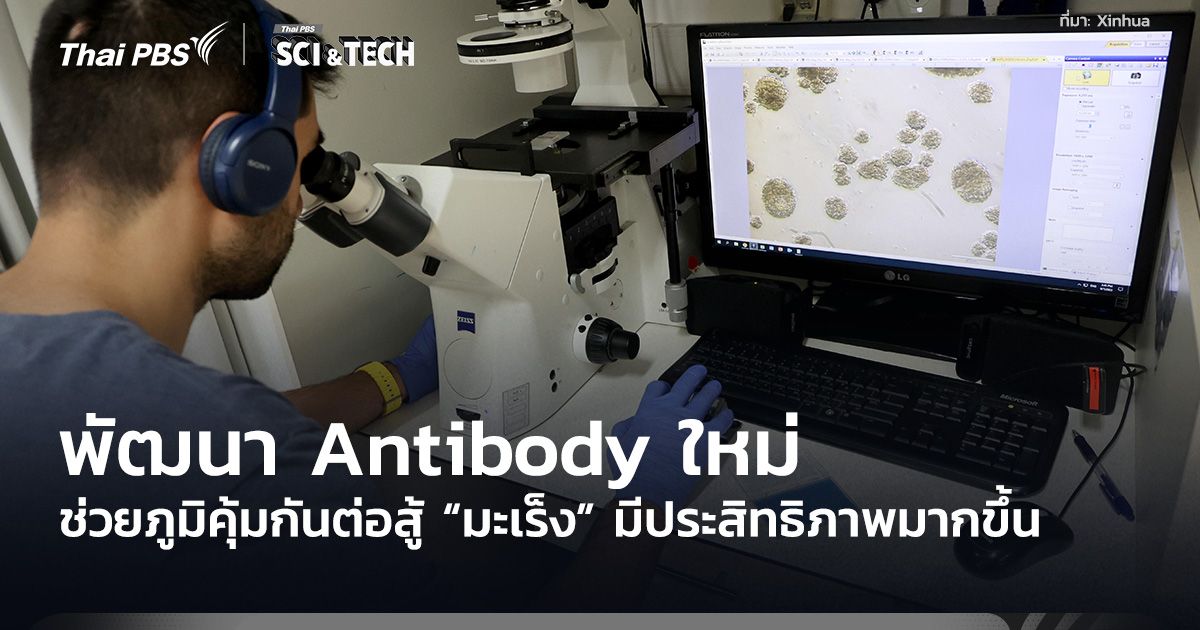 พัฒนา Antibody ใหม่ ช่วยภูมิคุ้มกันต่อสู้ “มะเร็ง” มีประสิทธิภาพมากขึ้น
