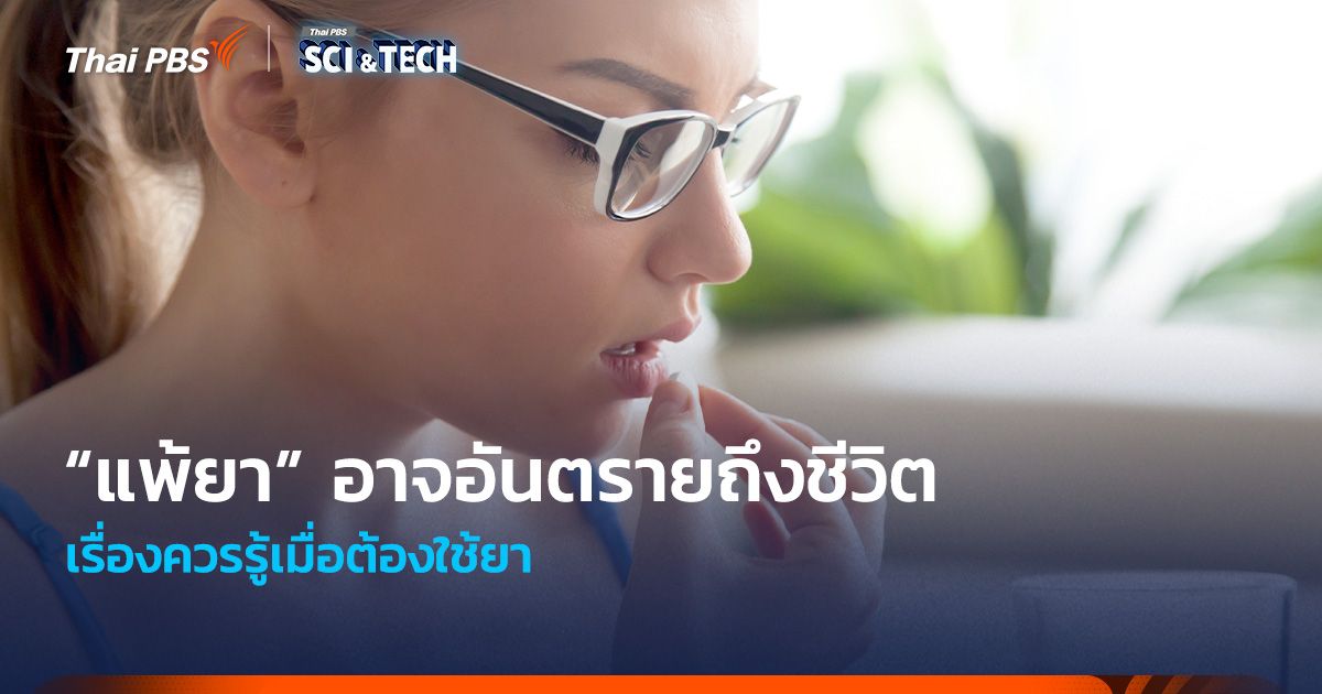 “แพ้ยา” อาจอันตรายถึงชีวิต เรื่องควรรู้เมื่อต้องใช้ยา