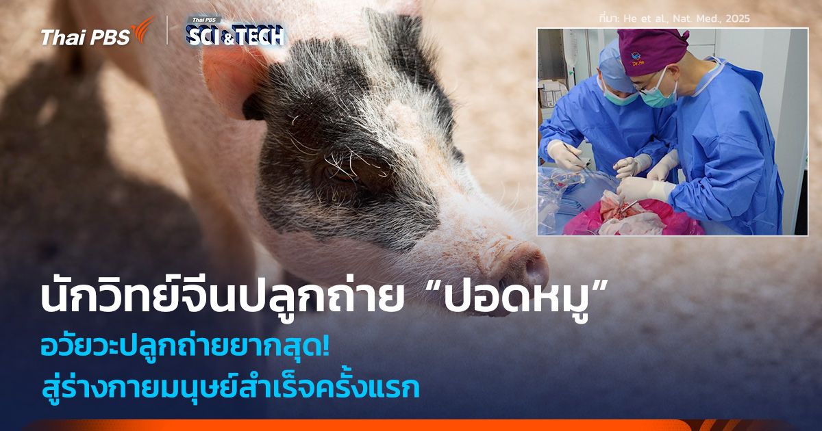 อวัยวะปลูกถ่ายยากสุด! นักวิทย์จีนปลูกถ่าย “ปอดหมู” สู่ร่างกายมนุษย์สำเร็จครั้งแรก