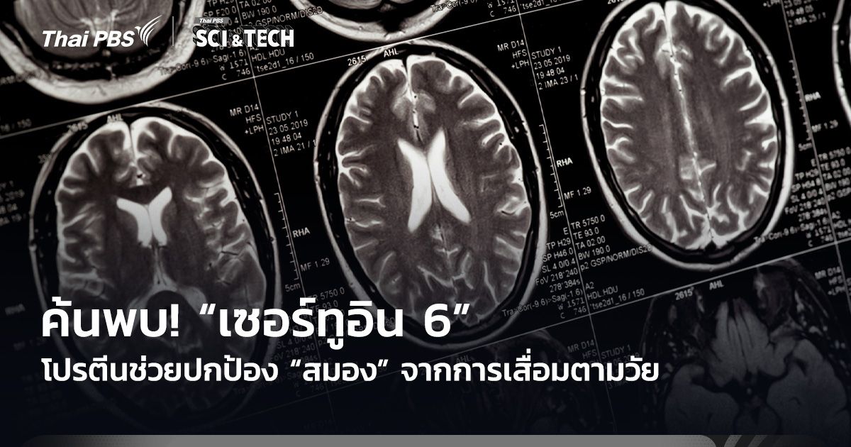 ค้นพบ! “เซอร์ทูอิน 6” โปรตีนช่วยปกป้อง “สมอง” จากการเสื่อมตามวัย