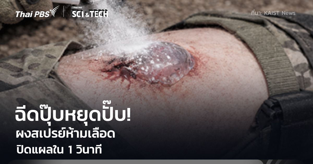 ฉีดปุ๊บหยุดปั๊บ! "ผงสเปรย์ห้ามเลือด" ปิดแผลใน 1 วินาที พลิกโฉมการกู้ชีพและลดการสูญเสีย
