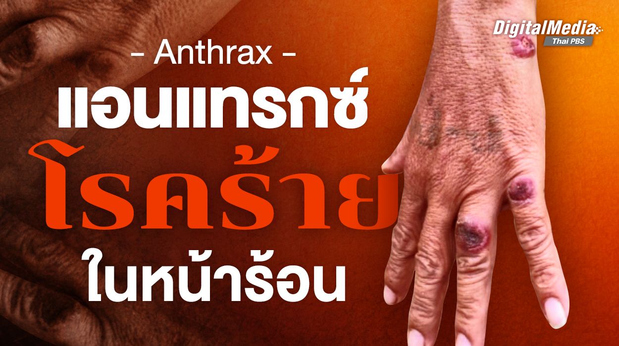 รู้จัก “แอนแทรกซ์” โรคร้ายในหน้าร้อนที่เสี่ยงต่อการเสียชีวิต