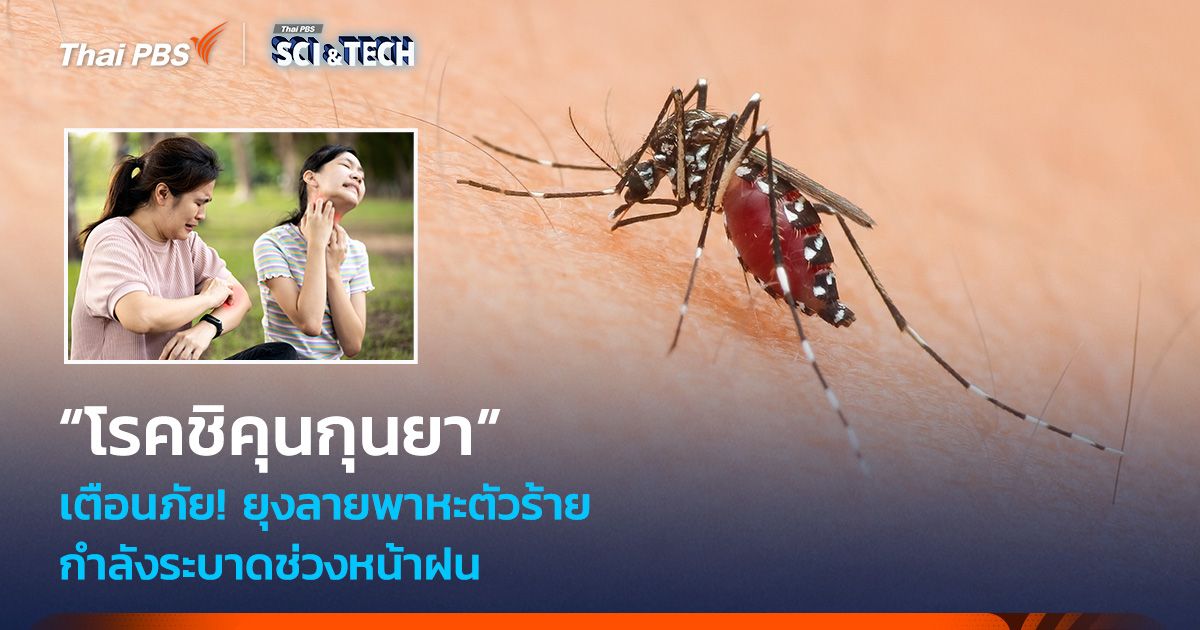 เตือนภัย! ยุงลายพาหะตัวร้าย “โรคชิคุนกุนยา” กำลังระบาดช่วงหน้าฝน 