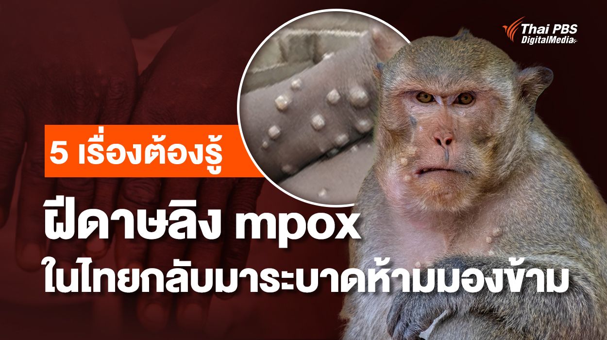 อัปเดต 5 เรื่องต้องรู้ “ฝีดาษลิง mpox” ในไทยกลับมาระบาดห้ามมองข้าม