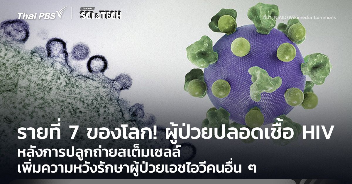 รายที่ 7 ของโลก! ผู้ป่วยปลอดเชื้อ HIV หลังการปลูกถ่ายสเต็มเซลล์