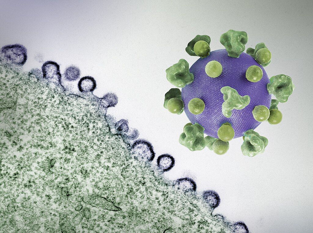 แบบจำลองอนุภาค HIV ที่พิมพ์แบบ 3 มิติ (ขวา) ถัดจากภาพไมโครกราฟสีของเซลล์ที่ติดเชื้อ ภาพจาก NIAID/Wikimedia Commons