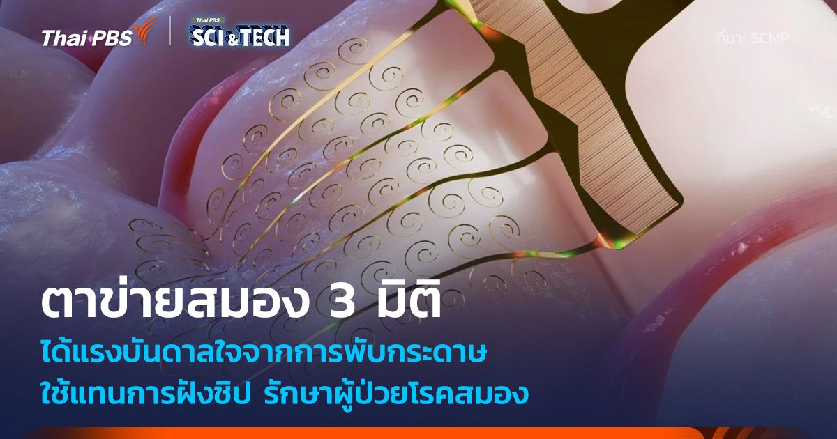 จากศิลปะพับกระดาษสู่ "ตาข่ายสมอง 3 มิติ" ช่วยรักษาผู้ป่วยโรคสมอง