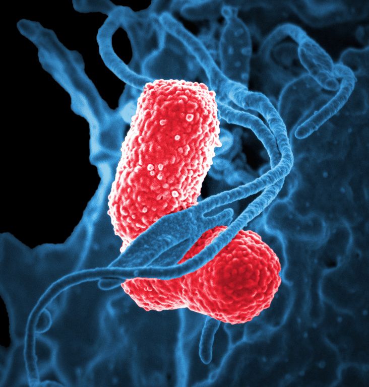 เชื้อดื้อยาปฏิชีวนะหลายชนิด Klebsiella pneumoniae