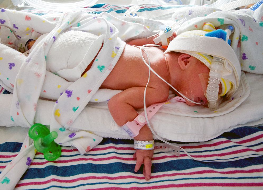 ภาพประกอบแสดงเด็กทารกแรกเกิดใน NICU