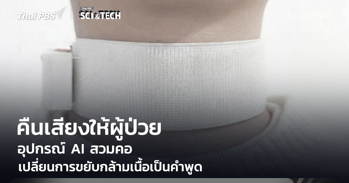 คืนเสียงให้ผู้ป่วย Stroke! อุปกรณ์ AI สวมคอ เปลี่ยนการขยับกล้ามเนื้อเป็นคำพูด สื่อสารได้อีกครั้ง