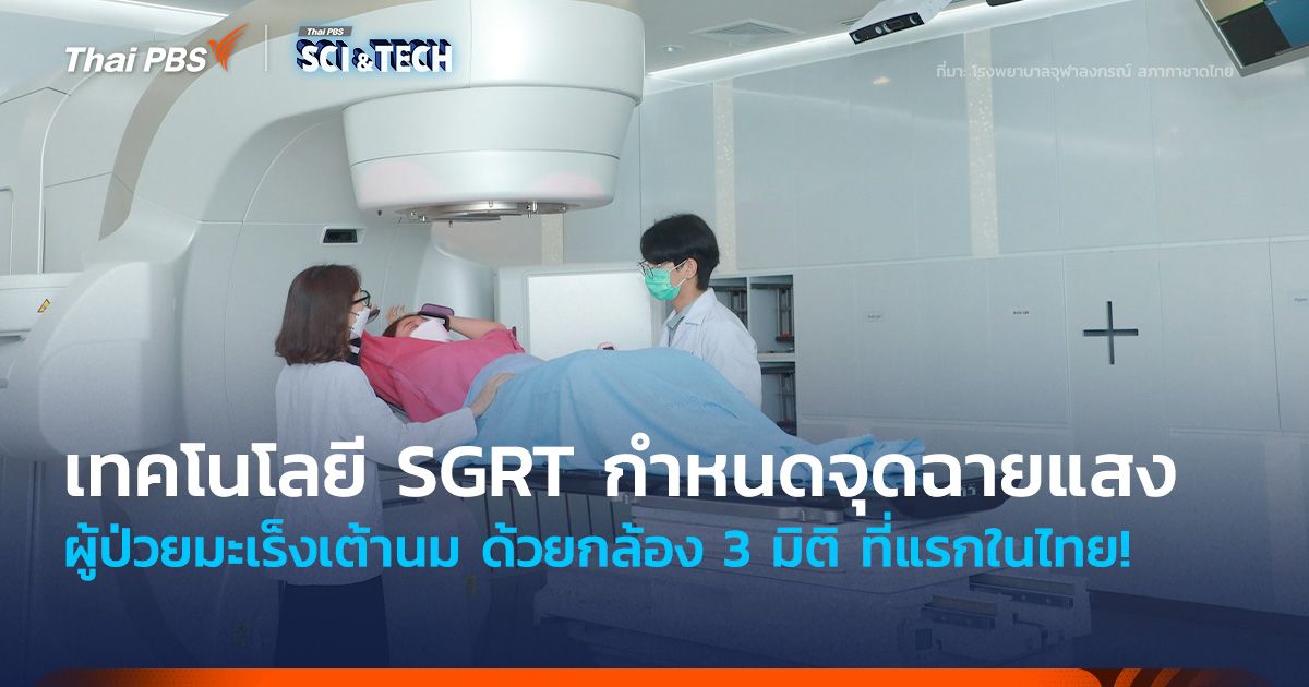 ที่แรกในไทย! นำเทคโนโลยี SGRT กำหนดจุดฉายแสงผู้ป่วยมะเร็งเต้านม ด้วยกล้อง 3 มิติ