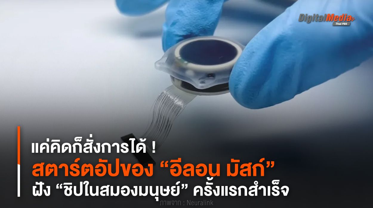 แค่คิดก็สั่งการได้ ! สตาร์ตอัปของ “อีลอน มัสก์” ฝัง “ชิปในสมองมนุษย์” ครั้งแรกสำเร็จ