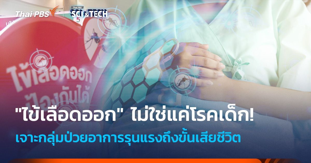 "ไข้เลือดออก" ไม่ใช่แค่โรคเด็ก! เจาะกลุ่มป่วยอาการรุนแรง เสี่ยงเสียชีวิต