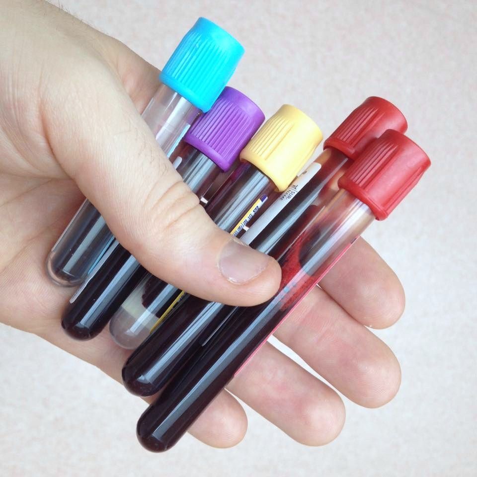 หลอดเก็บเลือดสุญญากาศที่เรียกว่า Vacutainer มีหลายสี ซึ่งใช้ต่างกัน