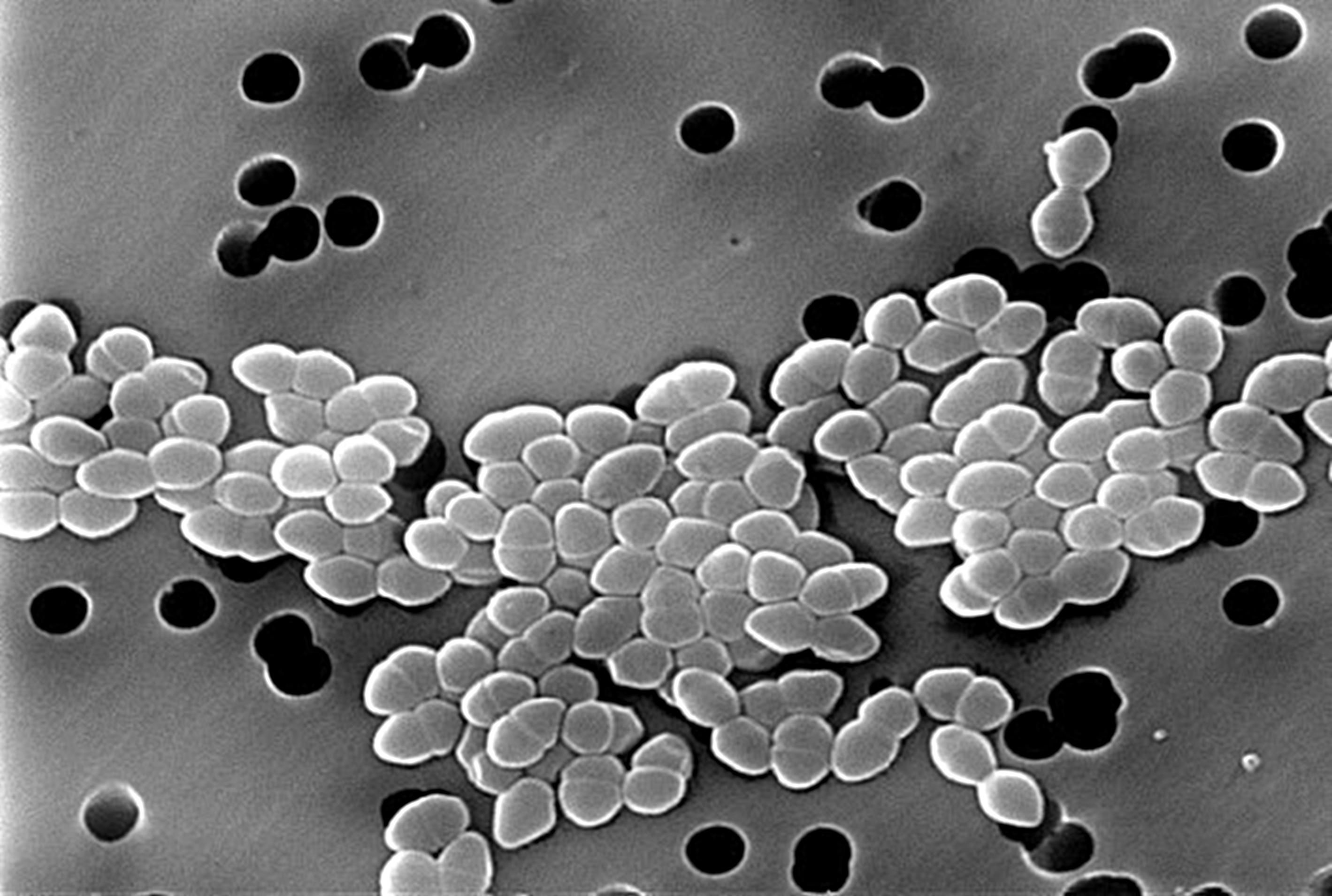 เชื้อดื้อยาปฏิชีวนะ Vancomycin (Vancomycin-resistant Enterococcus)