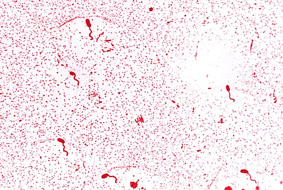 ภาพของเชื้อแบคทีเรีย Vibrio cholera