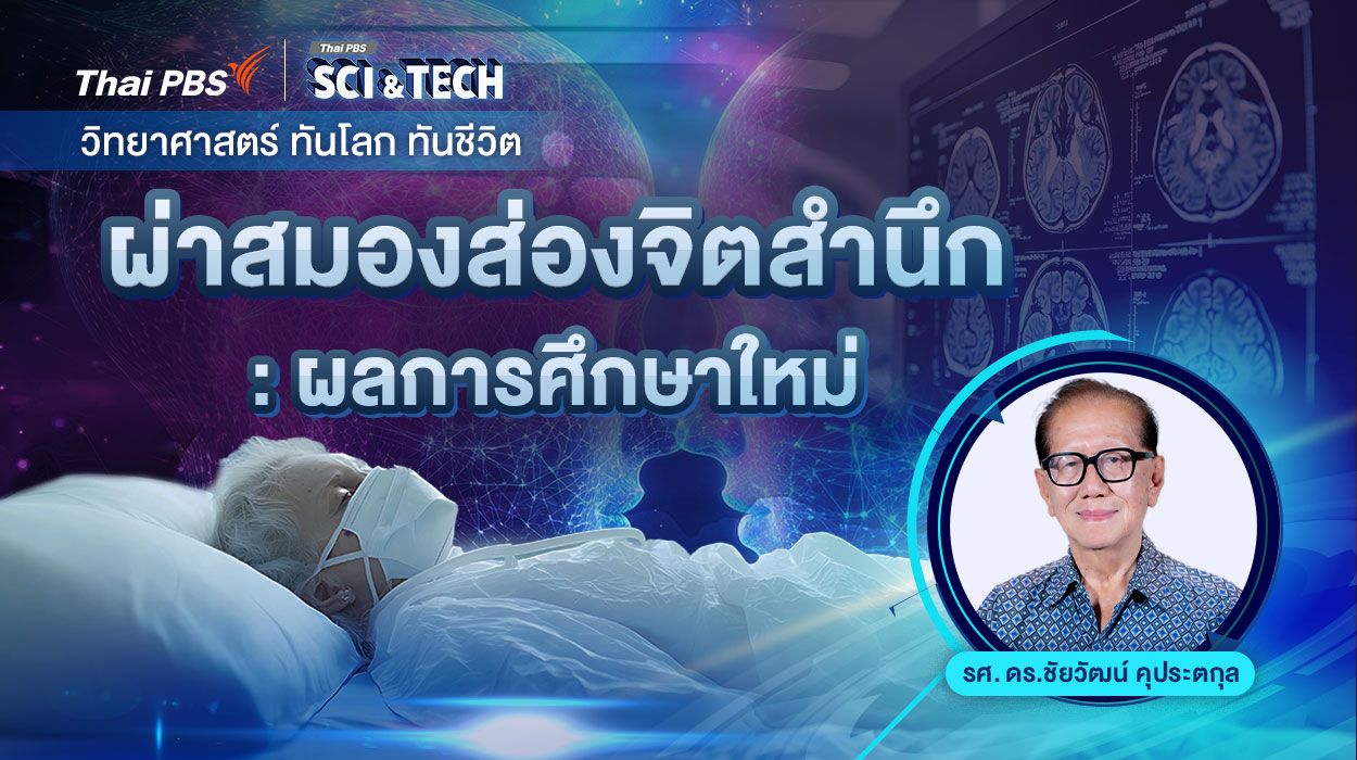 ผ่าสมองส่องจิตสำนึก : ผลการศึกษาใหม่