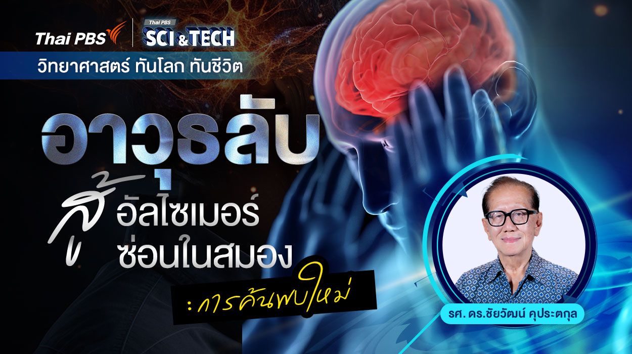 อาวุธลับสู้อัลไซเมอร์ซ่อนในสมอง : การค้นพบใหม่