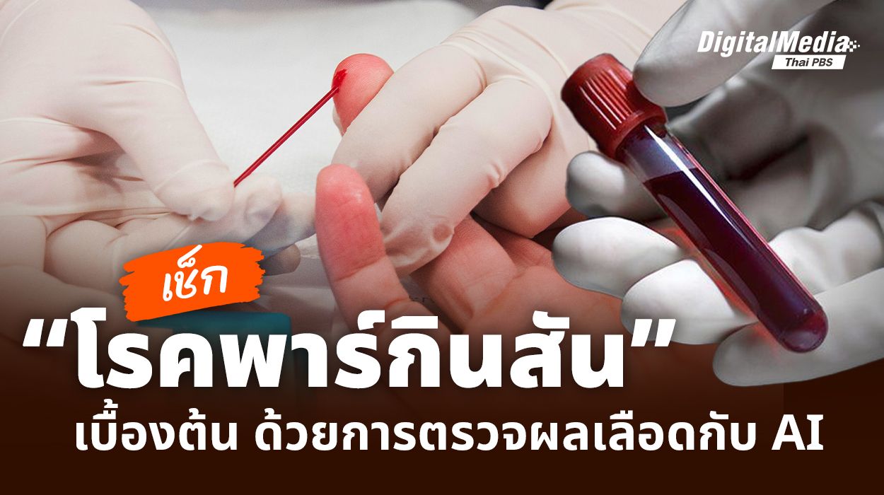 พาร์กินสัน รู้ล่วงหน้าจากการตรวจเลือดด้วย AI