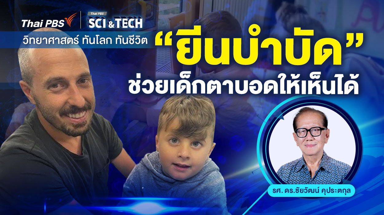 "ยีนบำบัด" ช่วยเด็กตาบอดให้เห็นได้