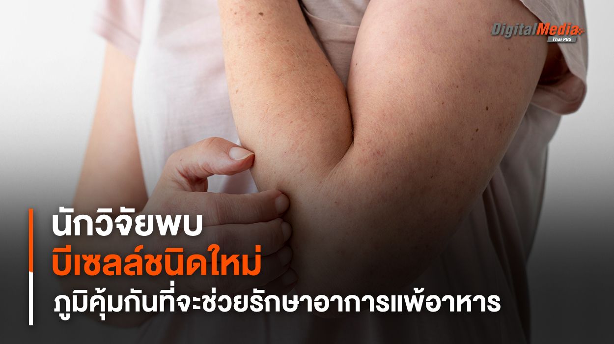 นักวิจัยพบบีเซลล์ชนิดใหม่ ภูมิคุ้มกันที่จะช่วยรักษาอาการแพ้อาหาร