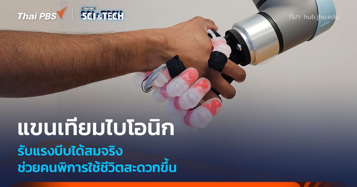 แขนเทียมไบโอนิก รับแรงบีบได้เหมือนมือจริง ช่วยคนพิการใช้ชีวิตสะดวกขึ้น
