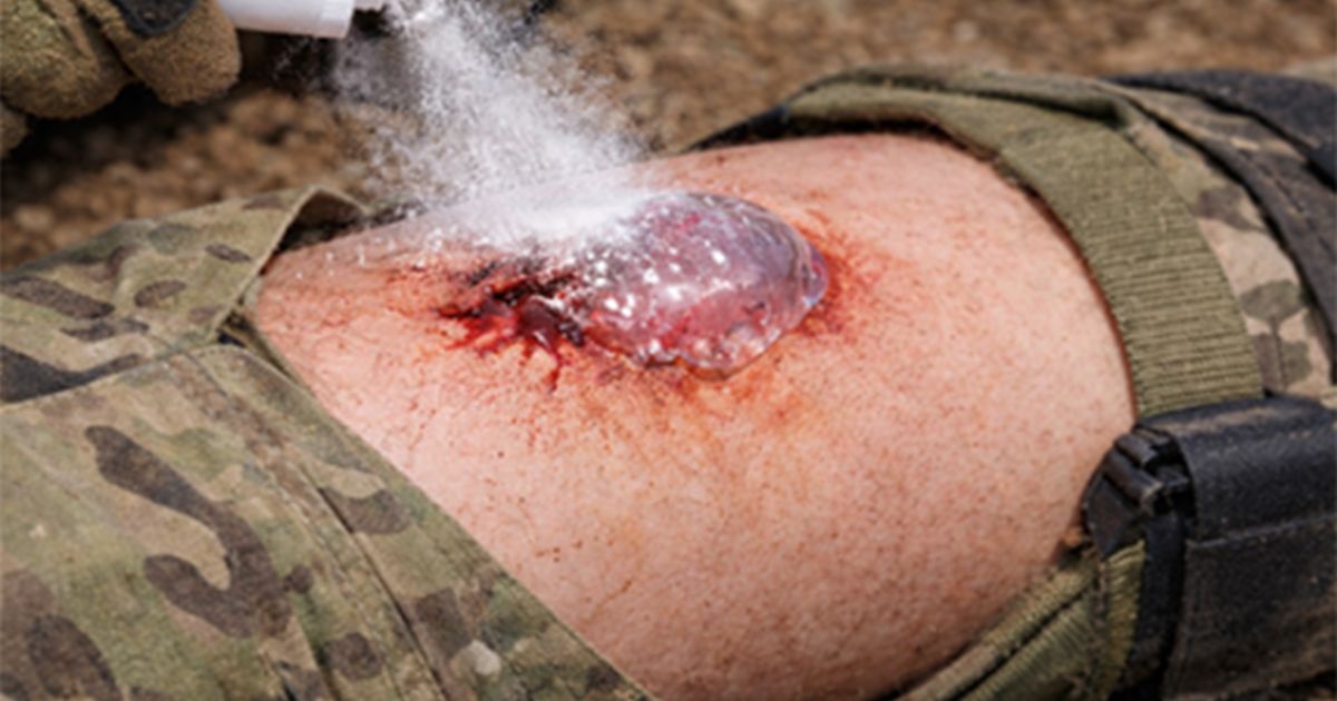 การใช้งาน ผงสเปรย์ห้ามเลือด ช่วยหยุดเลือดภายใน 1 วินาที