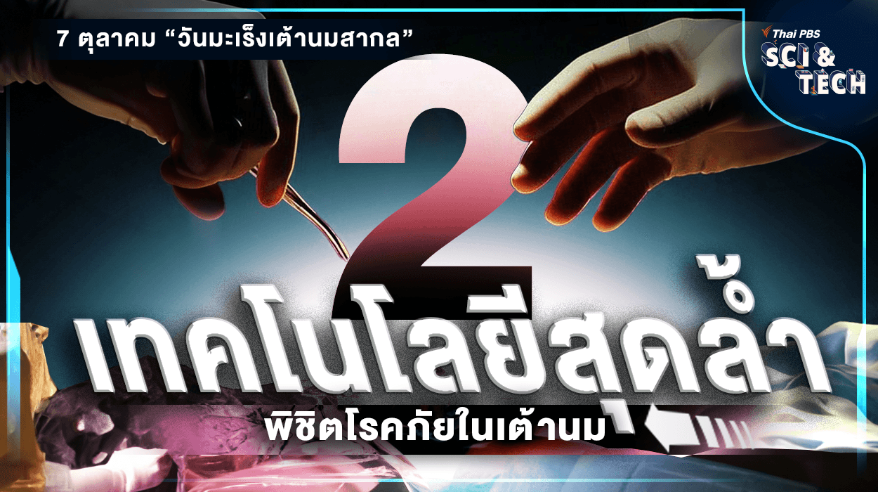 ชวนรู้จัก 2 เทคโนโลยีสุดล้ำ พิชิตโรคภัยในเต้านม