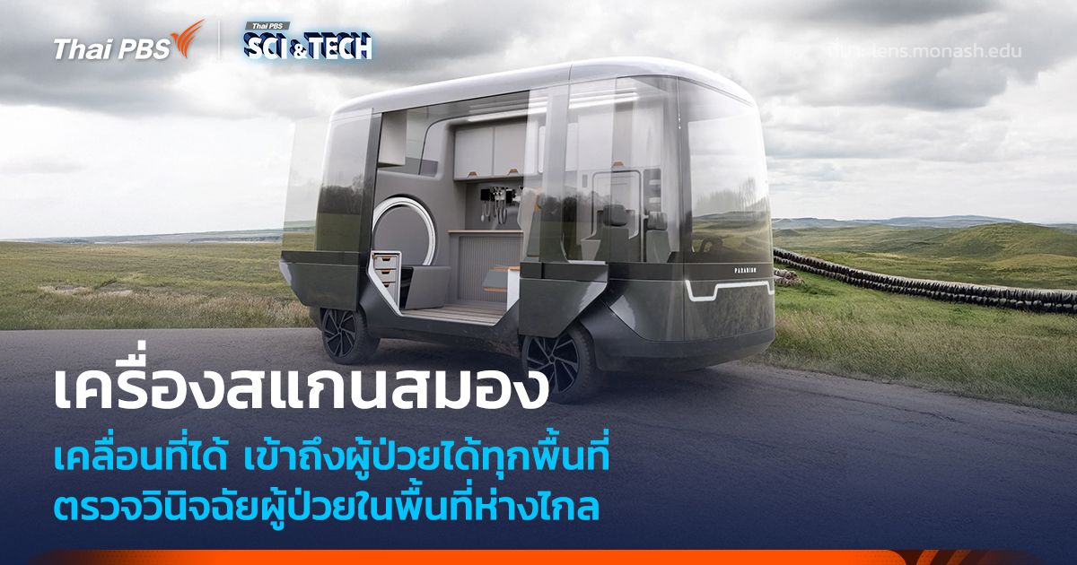 เครื่องสแกนสมองเคลื่อนที่ ตรวจวินิจฉัยผู้ป่วยในพื้นที่ห่างไกล