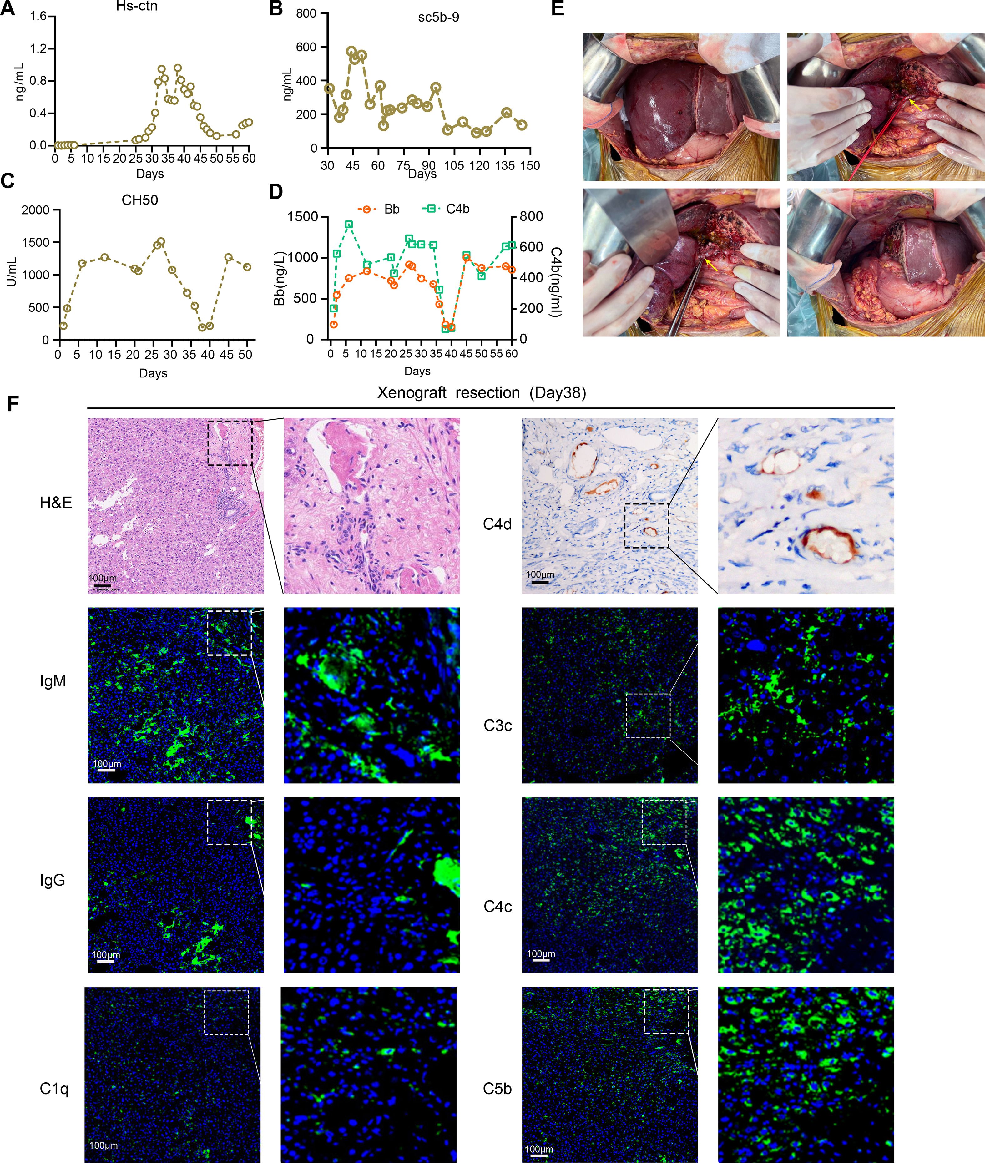 การผ่าตัดผู้ป่วยรับปลูกถ่าย “ตับหมู” คนแรกของโลก ภาพจาก journal-of-hepatology