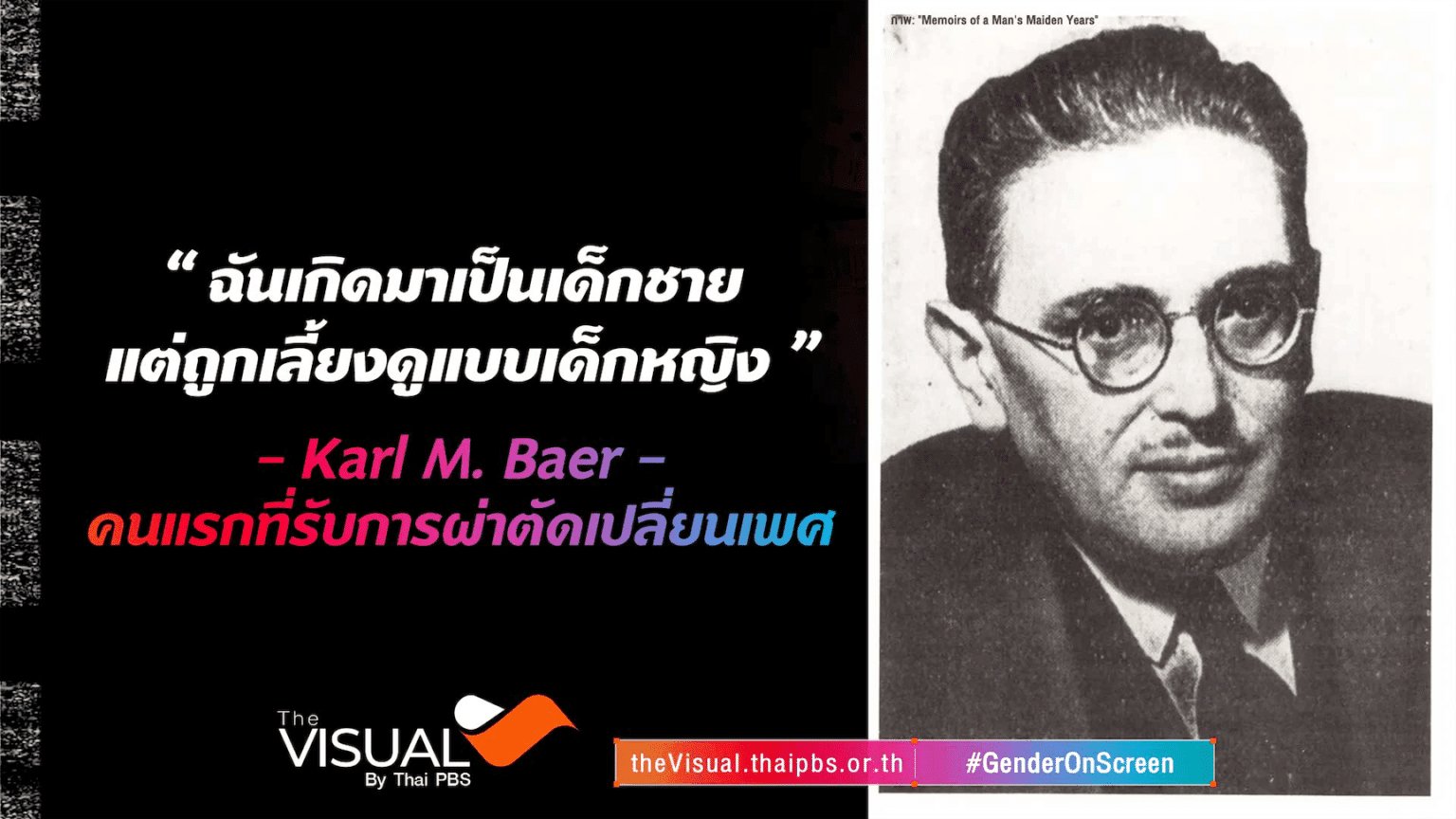“ฉันเกิดมาเป็นเด็กชาย แต่ถูกเลี้ยงดูแบบเด็กหญิง” Karl M. Baer คนแรกที่รับการผ่าตัดเปลี่ยนเพศ
