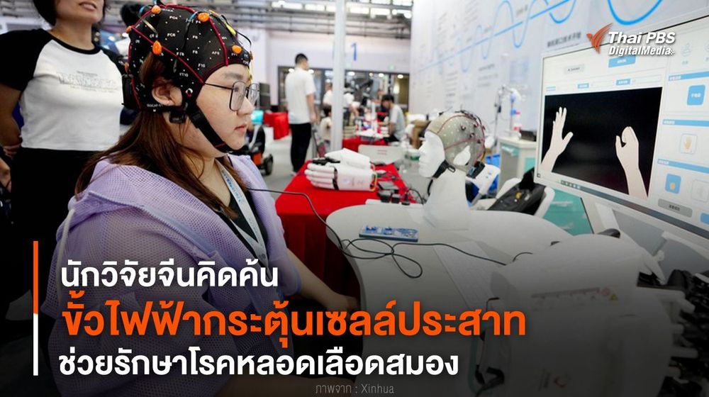 นักวิจัยจีนคิดค้น “ขั้วไฟฟ้ากระตุ้นเซลล์ประสาท” ช่วยรักษาโรคหลอดเลือดสมอง