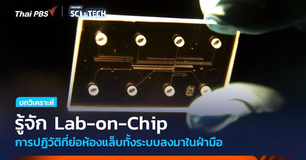 รู้จัก Lab-on-Chip การปฏิวัติที่ย่อห้องแล็บทั้งระบบลงมาในฝ่ามือ