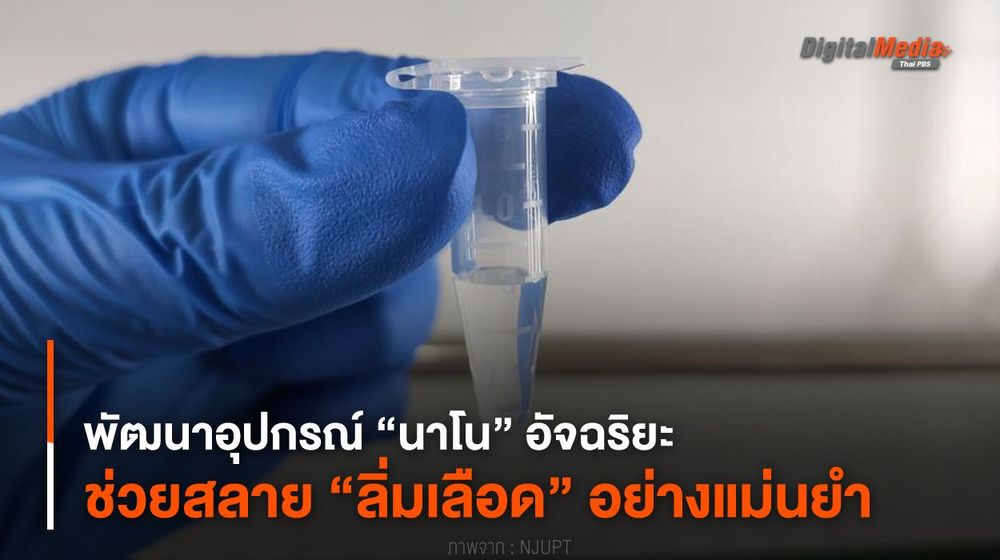 พัฒนาอุปกรณ์ “นาโน” อัจฉริยะ ช่วยสลาย “ลิ่มเลือด” อย่างแม่นยำ
