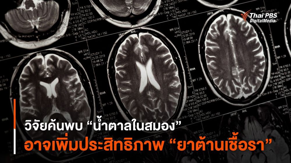 วิจัยค้นพบ “น้ำตาลในสมอง” อาจเพิ่มประสิทธิภาพ “ยาต้านเชื้อรา”