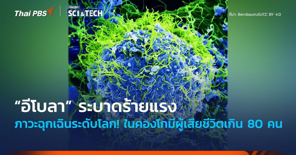 ภาวะฉุกเฉินระดับโลก! “อีโบลา” ระบาดร้ายแรง ในคองโกมีผู้เสียชีวิตเกิน 80 คน