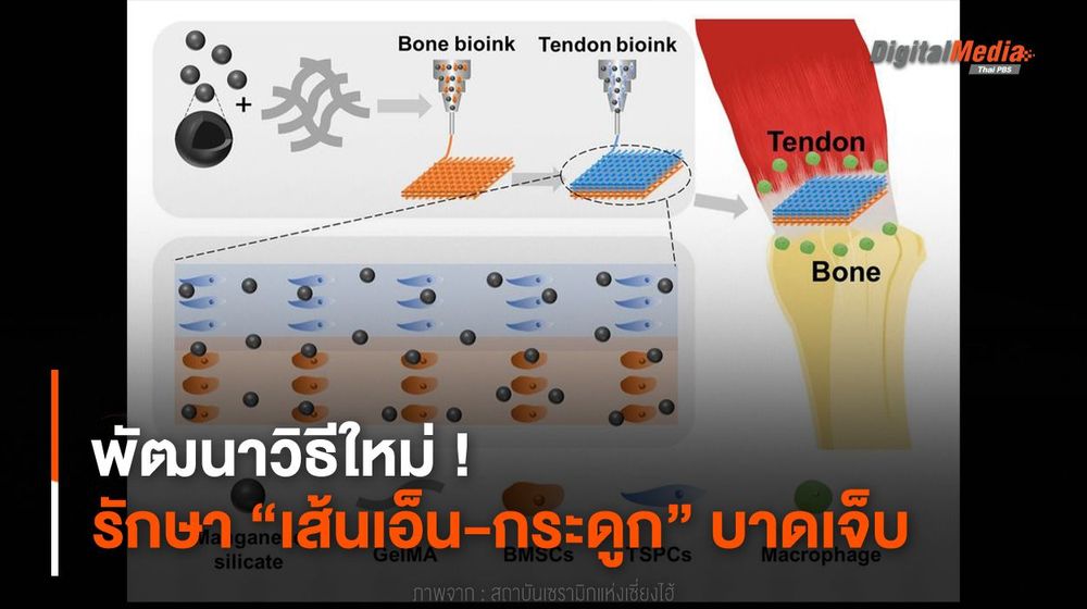 พัฒนาวิธีใหม่ ! รักษา “เส้นเอ็น-กระดูก” บาดเจ็บ