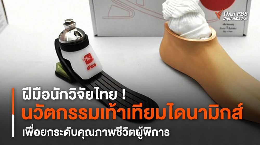 ฝีมือนักวิจัยไทย ! นวัตกรรมเท้าเทียมไดนามิกส์ เพื่อยกระดับคุณภาพชีวิตผู้พิการ